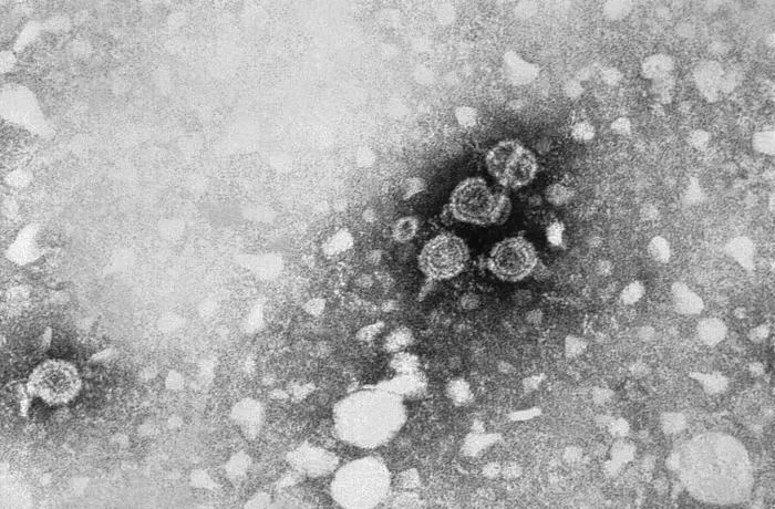 Microphotographie &eacute;lectronique r&eacute;elle de particules du virus de l&rsquo;h&eacute;patite B