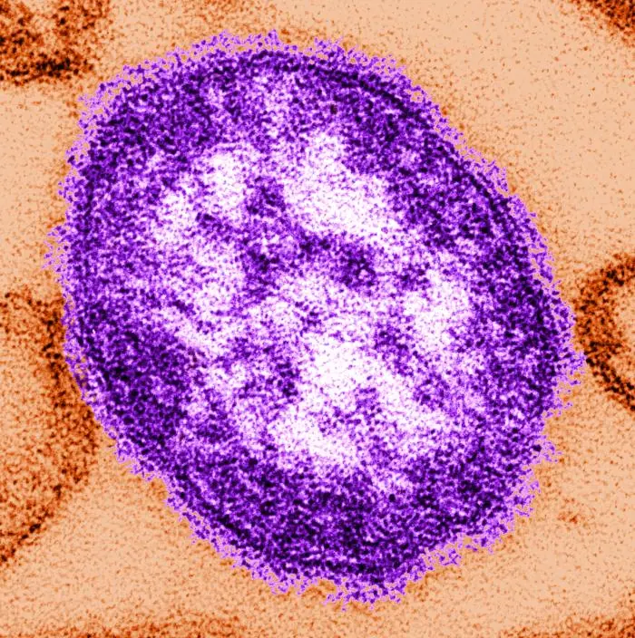 Microphotographie &eacute;lectronique du virus de la rougeole, coloris&eacute;e num&eacute;riquement