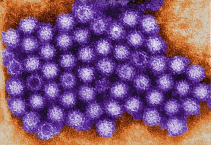 Microphotographie &eacute;lectronique r&eacute;elle de particules de norovirus, coloris&eacute;e num&eacute;riquement