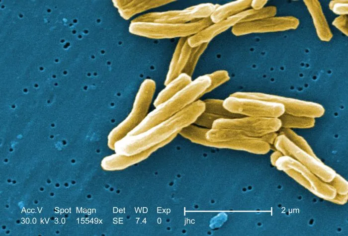 Microphotographie &eacute;lectronique r&eacute;elle de Mycobacterium tuberculosis, coloris&eacute;e num&eacute;riquement